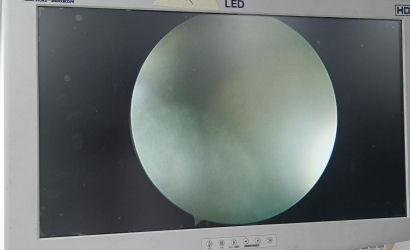 STRYKER關節鏡0502-104-030維修案例分析