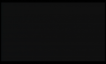 經皮腎鏡手術治療及STORZ經皮腎鏡 26092AMA維修案例分析